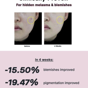 The Niacinamide 15 Serum