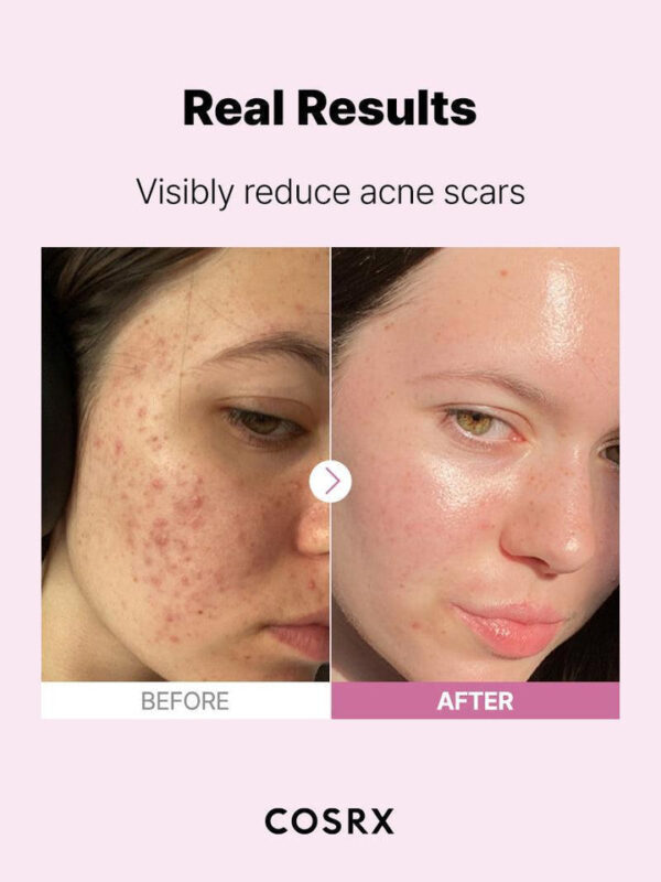 The Niacinamide 15 Serum – Image 5
