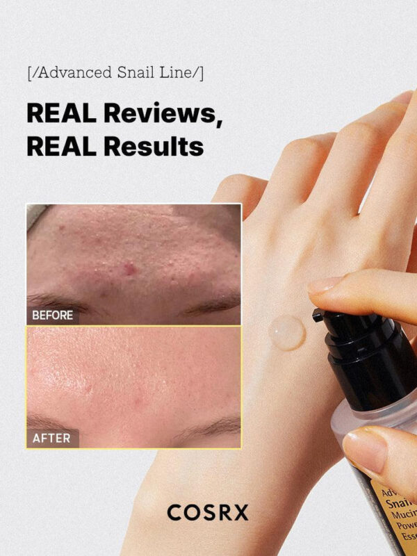 Advanced Snail 96 Mucin Power Essence – Image 7